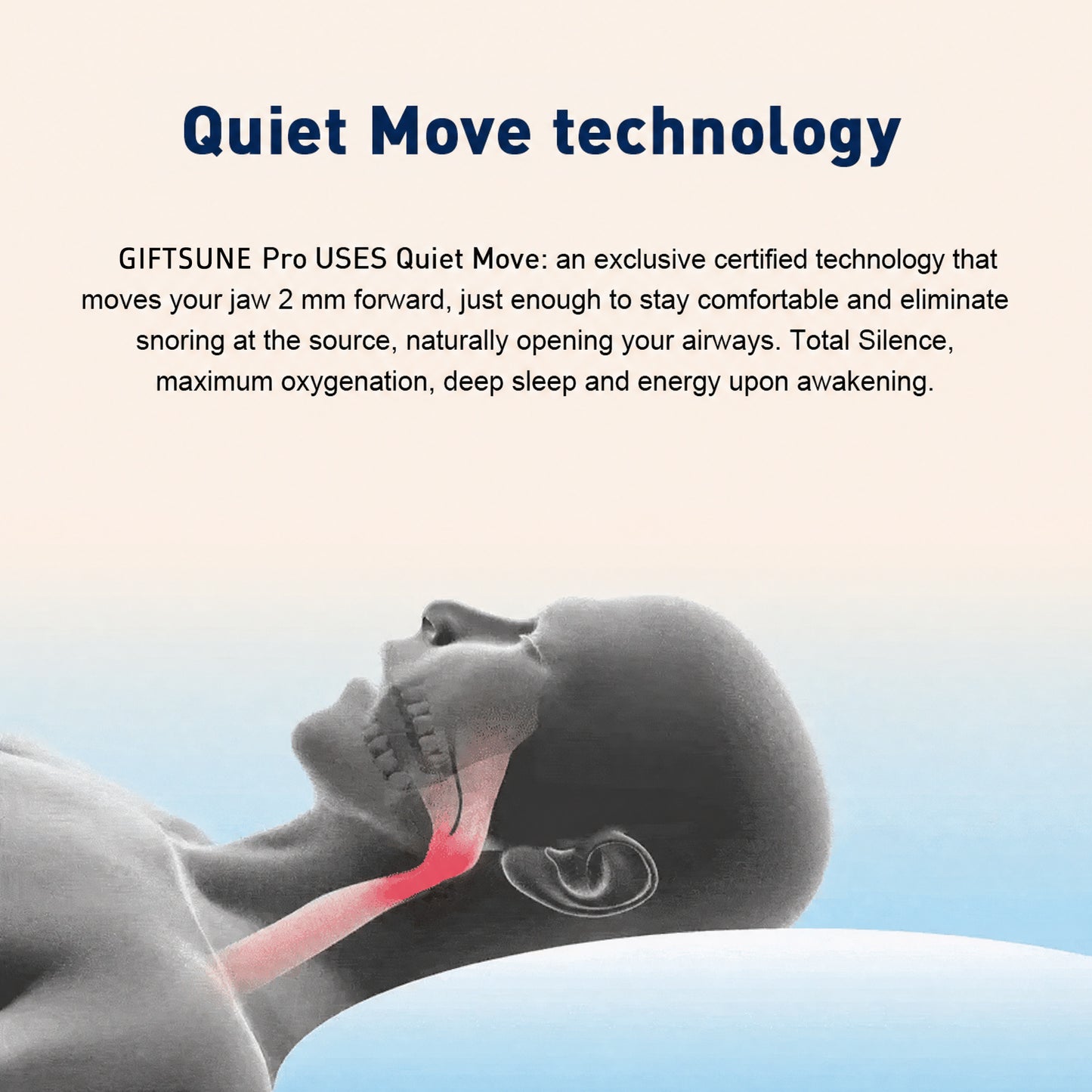 🔥Giftsune™  Professional intelligent anti-snoring device