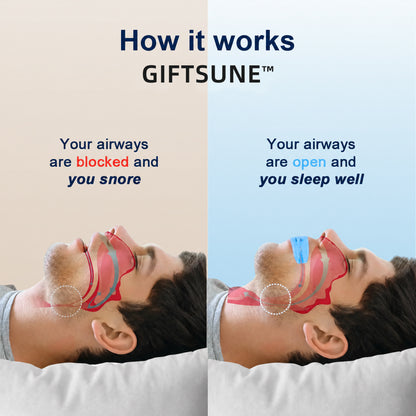 🔥Giftsune™  Professional intelligent anti-snoring device